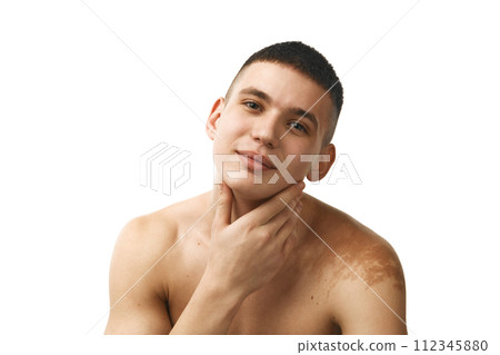Portrait of handsome young guy with birthmark on shoulders, standing shirtless isolated over white studio background Portrait of handsome young guy with birthmark on shoulders, standing shirtless isolated over white studio background 112345880