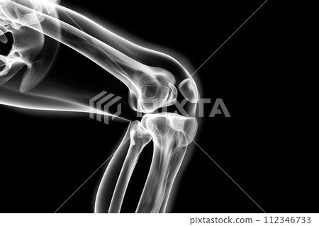 Side view of knee joint 112346733
