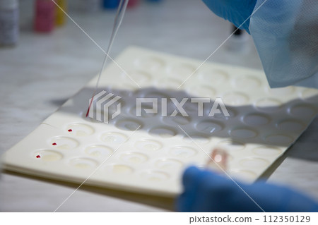 Blood test.Microbiological examination of blood 112350129