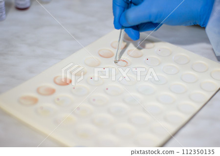 Blood test 112350135