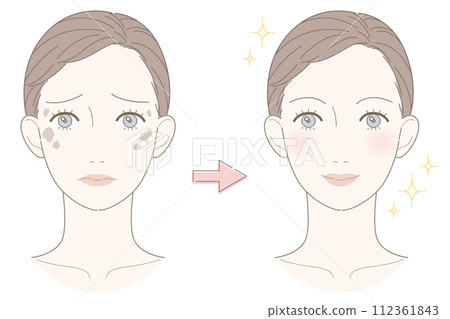 Stain female before and after illustration 112361843