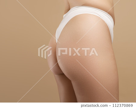 A real female body. Skin with imperfections - A real female body. Skin with imperfections - 112370869