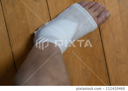 injured leg injured leg 112420468