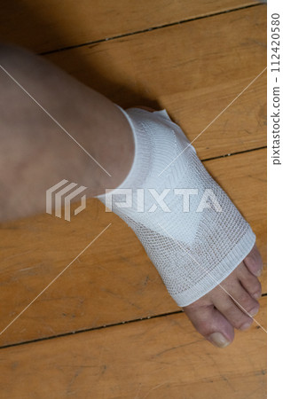 injured leg injured leg 112420580