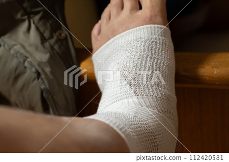 受傷的腿 112420581