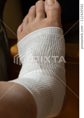 受傷的腿 受傷的腿 112420582
