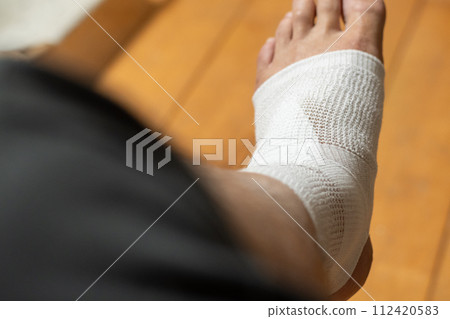 injured leg injured leg 112420583