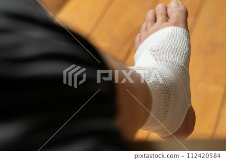 injured leg injured leg 112420584