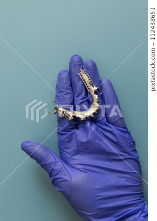 Metal Frame Lower Partial Denture, Cobalt Chrome Dental Plate, Bridge Printed By 3d Printer in Doctor's Hand. Blue Background. Flat Lay Mockup. Copy Space For Text.Vertical. Dentistry 112438651