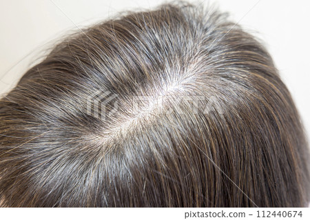 Colored hair, top of head Colored hair, top of head 112440674