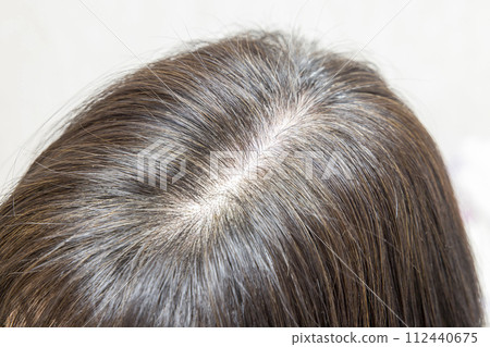 Colored hair, top of head Colored hair, top of head 112440675