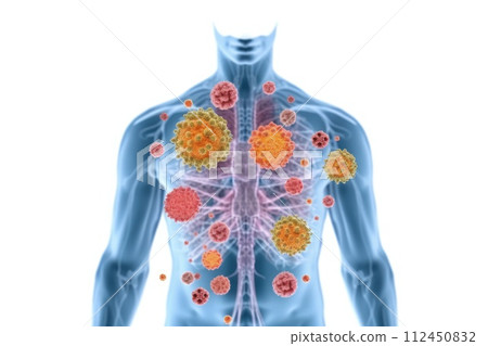 Immune defense , protecting your health and well-being through a strong immune system and disease prevention. 112450832