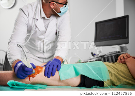 Male specialist examination of patient's knee in his office, boy patient lying on coach. Doctor wearing white robe, latex gloves, glasses and mask. Concept of checkup and healthcare. Male specialist examination of patient's knee in his office, boy patient lying on coach. Doctor wearing white robe, latex gloves, glasses and mask. Concept of checkup and healthcare. 112457856