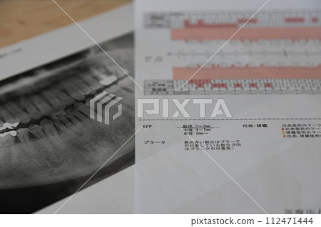 牙醫拍攝的X光照片和牙周病測試表 牙醫拍攝的X光照片和牙周病測試表 112471444