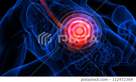 stomach pain anatomy for medical concept 3d rendering stomach pain anatomy for medical concept 3d rendering 112472369