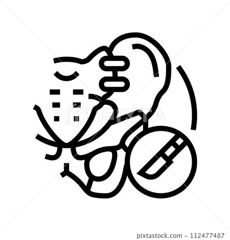 joint fusion surgery line icon vector illustration joint fusion surgery line icon vector illustration 112477487