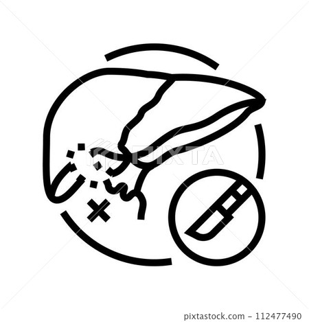 cholecystectomy surgery line icon vector illustration 112477490
