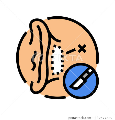 otoplasty surgery color icon vector illustration 112477829