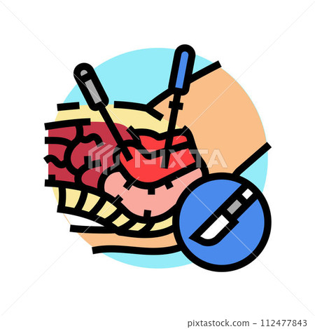 gynecologic laparoscopy color icon vector illustration gynecologic laparoscopy color icon vector illustration 112477843