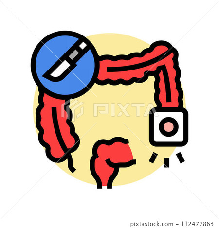 colostomy surgery color icon vector illustration colostomy surgery color icon vector illustration 112477863