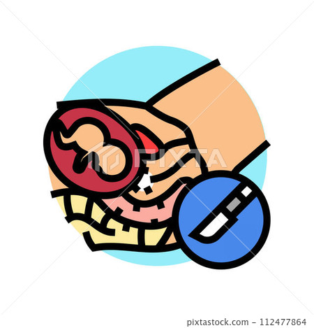 cervical cerclage surgery color icon vector illustration cervical cerclage surgery color icon vector illustration 112477864