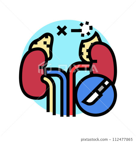 adrenalectomy surgery color icon vector illustration adrenalectomy surgery color icon vector illustration 112477865