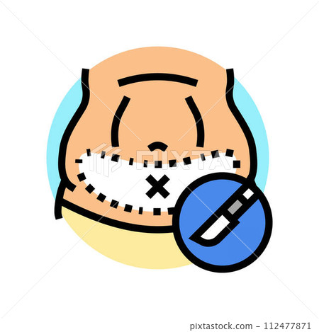 tummy tuck abdominoplasty surgery color icon vector illustration tummy tuck abdominoplasty surgery color icon vector illustration 112477871