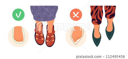 Healthy feet shoes. Foot deformity cause. Female uncomfortable narrow footwear. Orthopedic boots. Valgus prevention. Woman footgear. Leg hallux disease infographic. Garish vector concept Healthy feet shoes. Foot deformity cause. Female uncomfortable narrow footwear. Orthopedic boots. Valgus prevention. Woman footgear. Leg hallux disease infographic. Garish vector concept 112495456