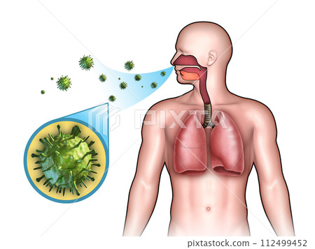 Viral infection Viral infection 112499452