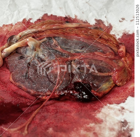 placenta 112513026