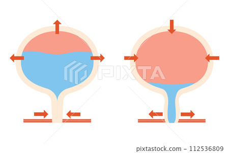 Medical illustration of normal bladder, mechanism of urination Medical illustration of normal bladder, mechanism of urination 112536809