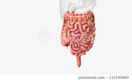 Epiploic appendages are normal outpouchings of peritoneal fat on the anti-mesenteric surface of the colon 112540063
