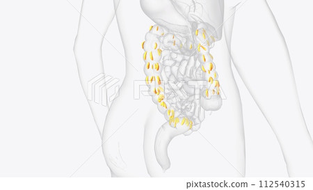 Epiploic appendages are normal outpouchings of peritoneal fat on the anti-mesenteric surface of the colon Epiploic appendages are normal outpouchings of peritoneal fat on the anti-mesenteric surface of the colon 112540315