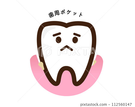 Teeth disappointed with stains in periodontal pockets 112560147