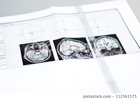 Image of the brain on the results of the study 112561575