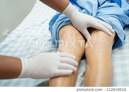 Doctor checking Asian elderly woman patient with scar knee replacement surgery in hospital. Doctor checking Asian elderly woman patient with scar knee replacement surgery in hospital. 112610018