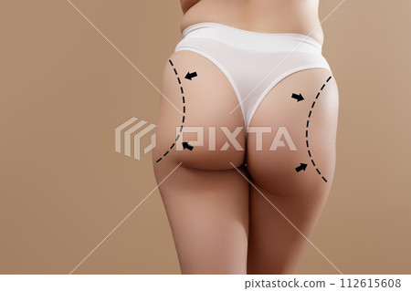 Female body with the drawing arrows. Buttocks, hip Female body with the drawing arrows. Buttocks, hip 112615608