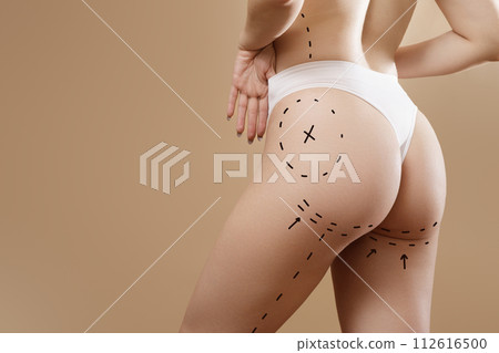 Female body with the drawing arrows. Buttocks, hip 112616500