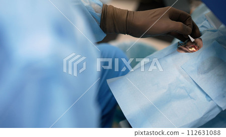 Surgeon's hands in gloves performing laser vision correction, eye surgery. Vision correction procedure, doctor's hands in gloves, close-up. Cataract surgery close up. 112631088