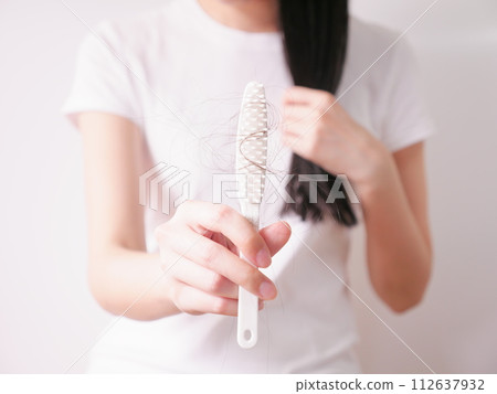 Hair loss 03 Hair loss 03 112637932