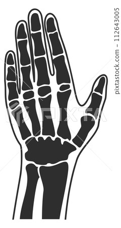 Human palm xray. Hand bones anatomy illustration 112643005