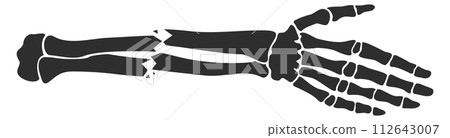 Broken hand bones. Bone fracture. Injury icon 112643007