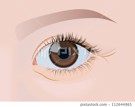 black eyes under the eyes 112644865