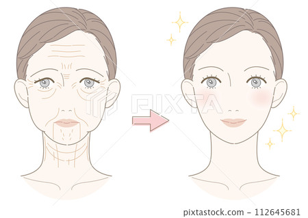 皺紋和下垂的女人前後插圖 112645681
