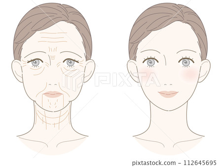 Wrinkle sagging improvement woman illustration 112645695