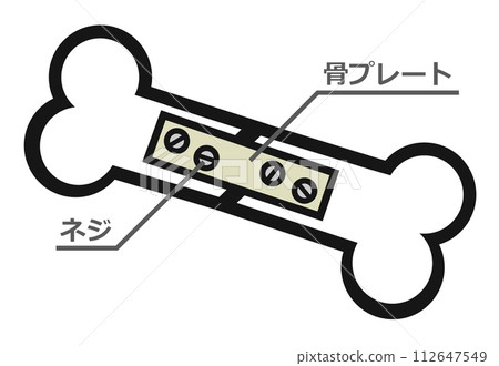 意外骨折治療圖解 112647549