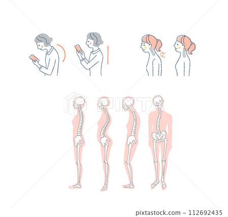 Correct posture and bad posture Straight neck Correct posture and bad posture Straight neck 112692435