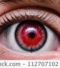 Red eyes [close-up] 112707102