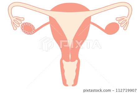 多囊性卵巢症候群（成熟障礙）插圖、子宮和卵巢解剖圖 112719907