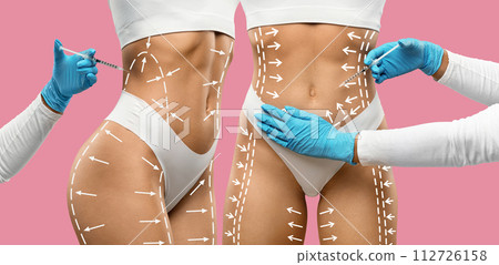 Cropped of two women got injection in waist 112726158